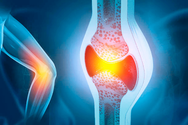 Prévention des maladies articulaires